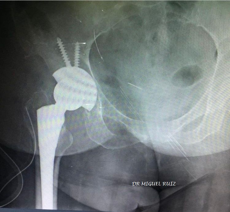 Miguel Angel Ruiz Resendiz-4