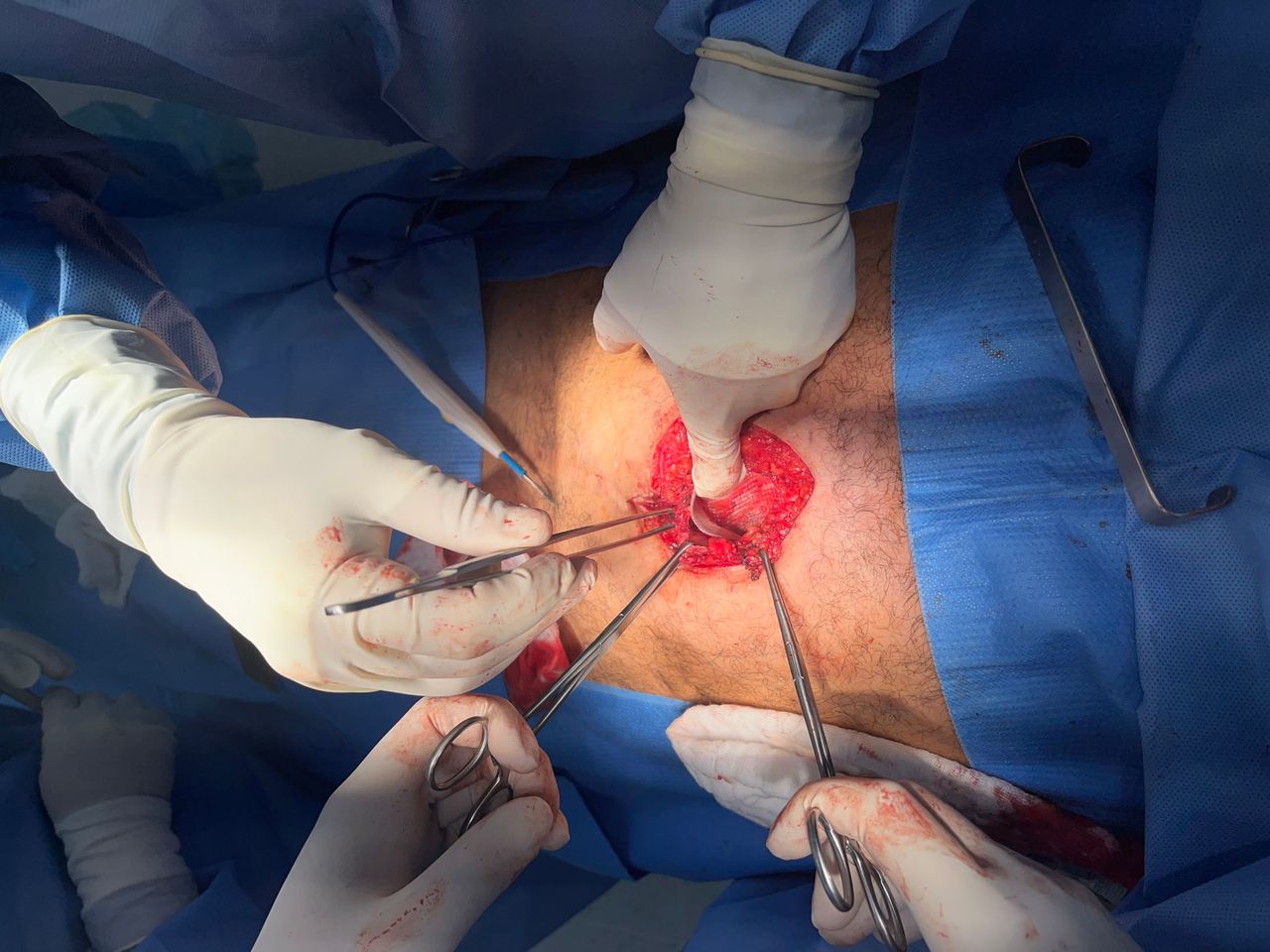 Luis Angel Medina Andrade-11