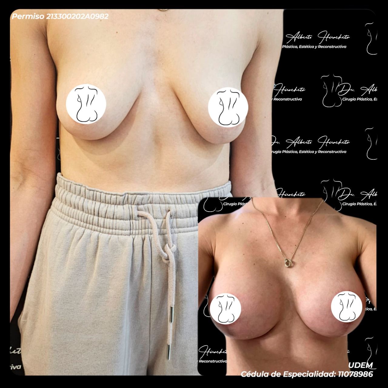 Alberto Hiracheta Torres-4