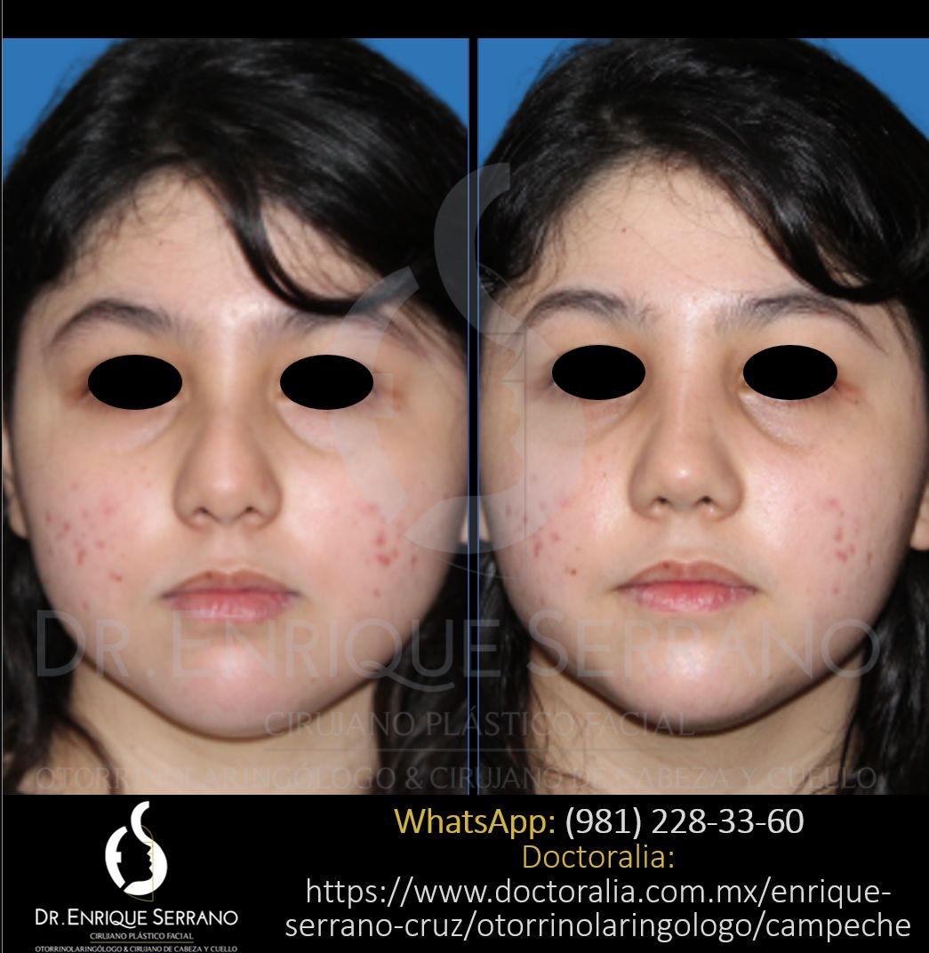 Enrique Serrano Cruz-49