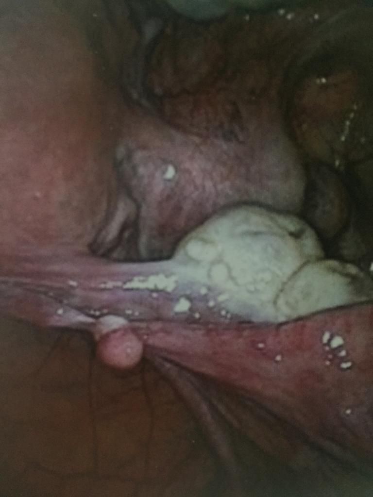 Alfredo Mendez Samano-12