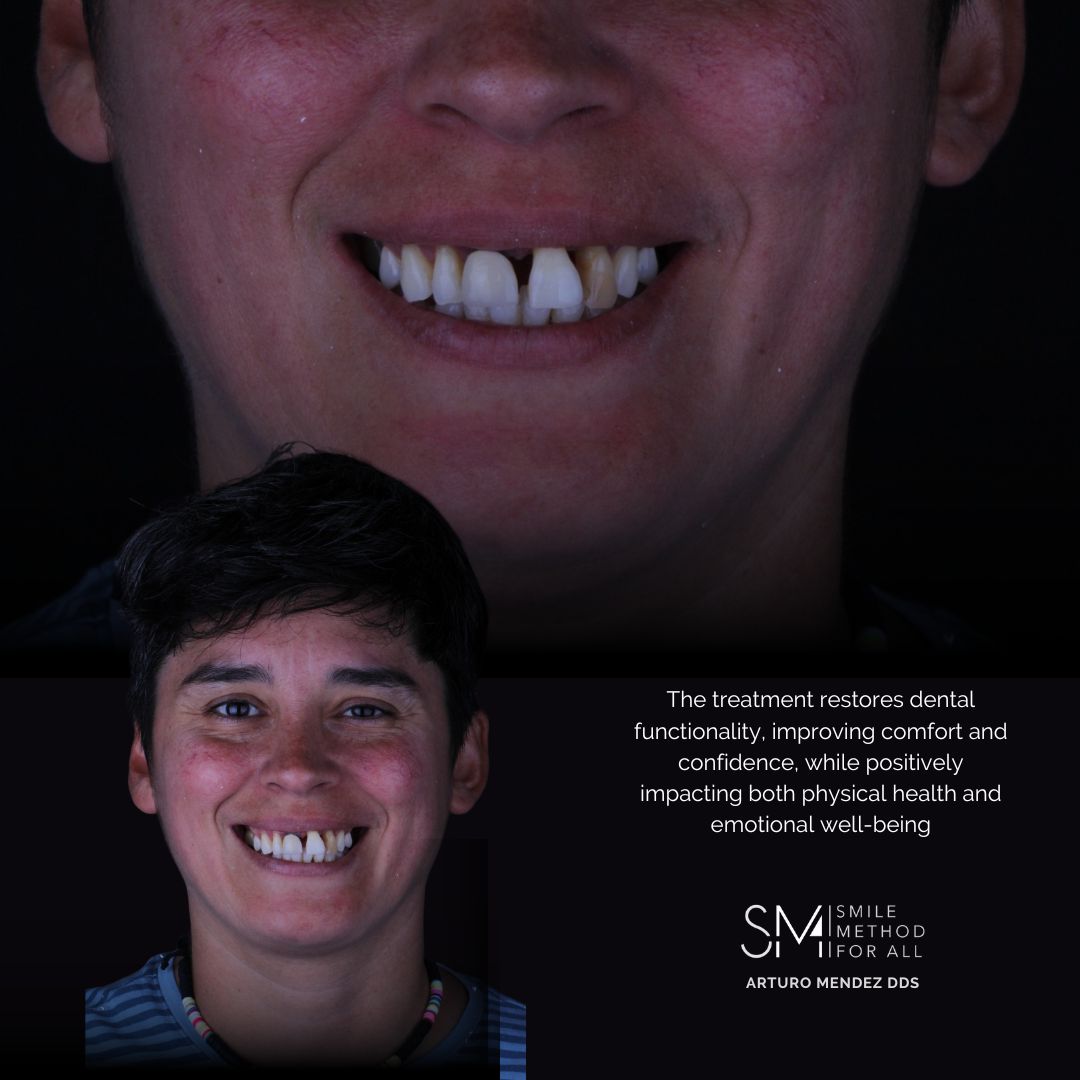 Arturo Mendez Valencia-35