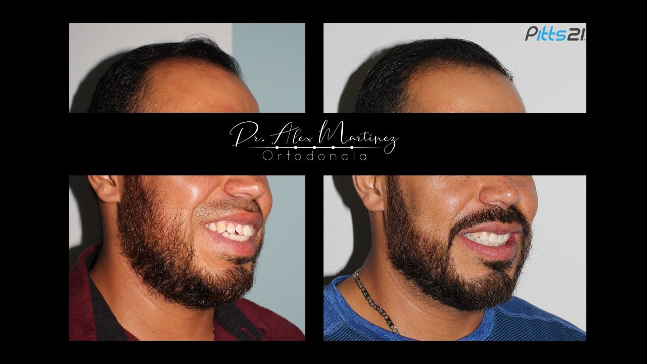 Alejandro Martínez Hernández-8