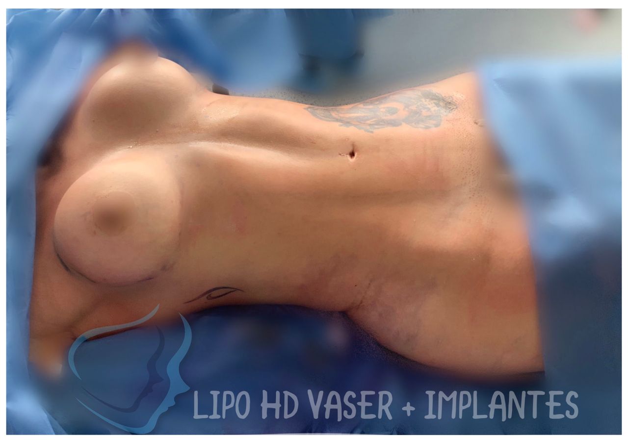 Giuseppe Tanzillo-40