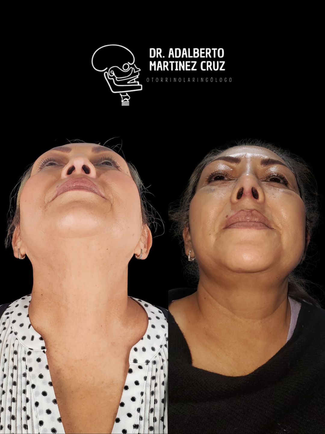 Adalberto Martínez Cruz-20