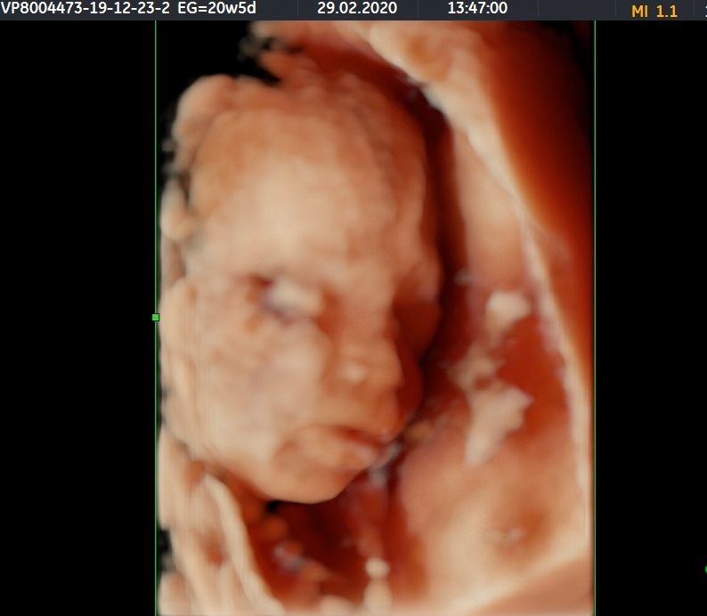 Susele Lara Rodríguez-2