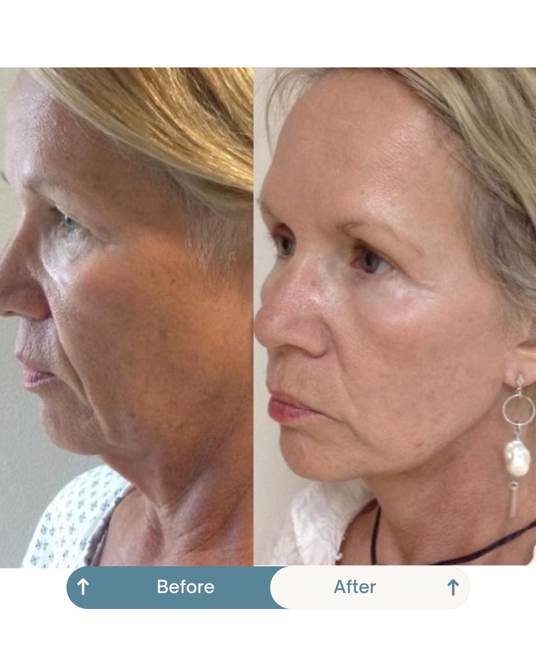 Nashielli Torres Espinosa Chiu-21