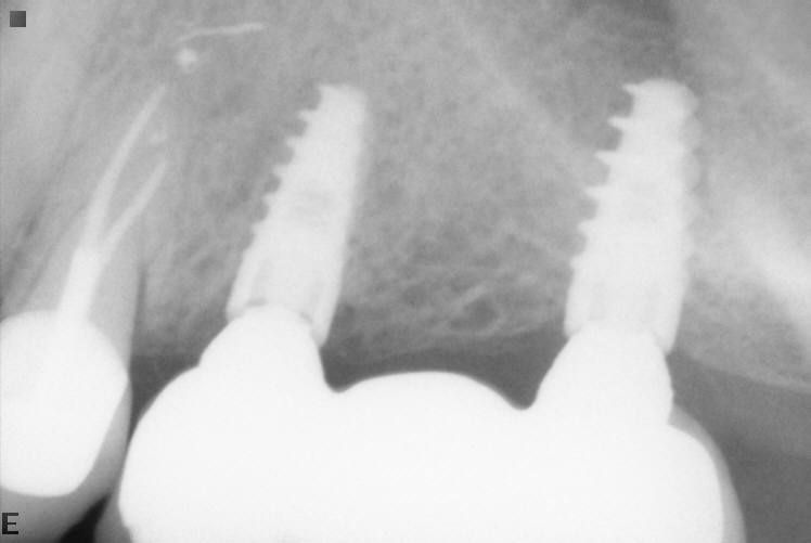 Josué Márquez Gómez-24