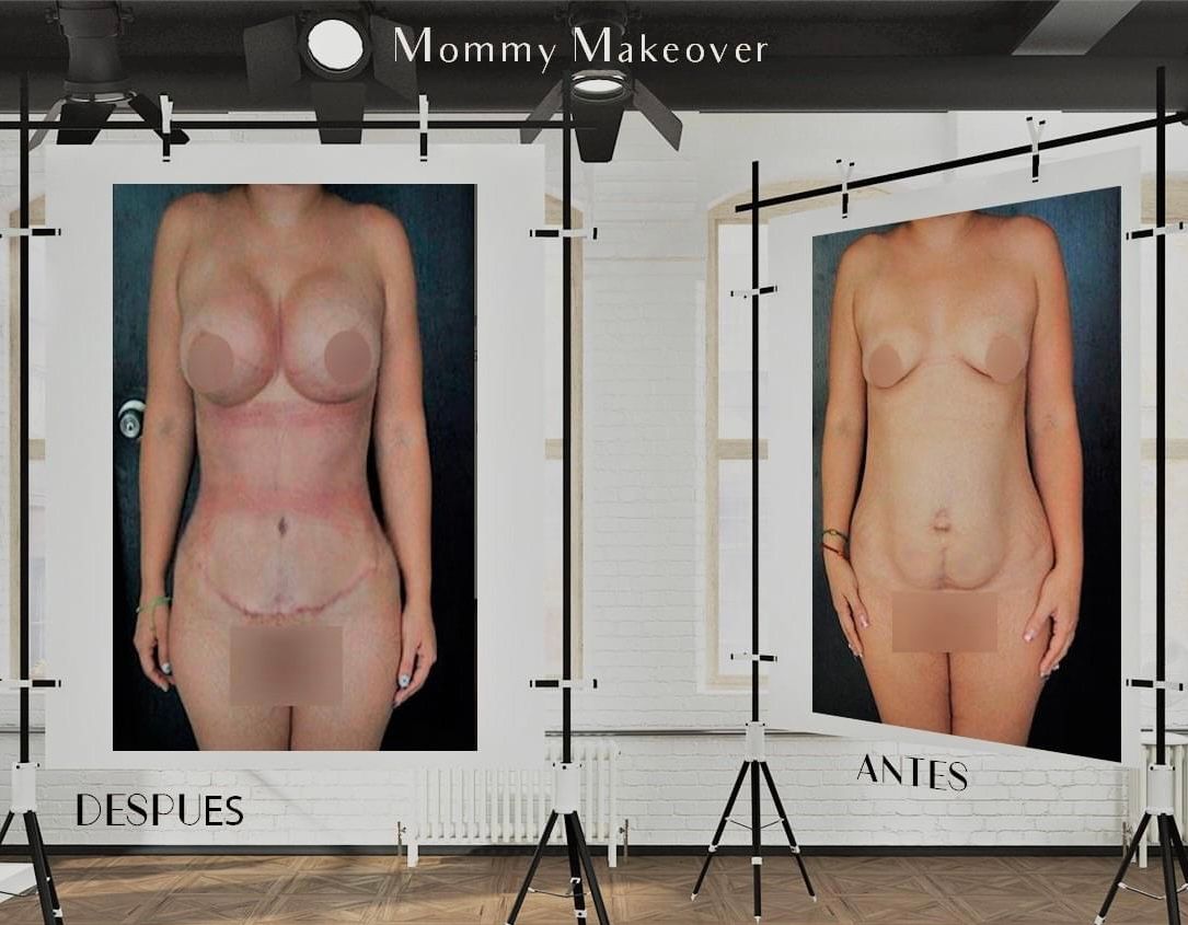 Carlos Gerardo Alfaro Moreno-11