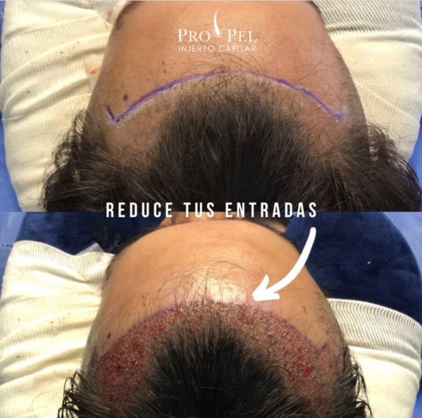 Karla Vanessa Becerra-36