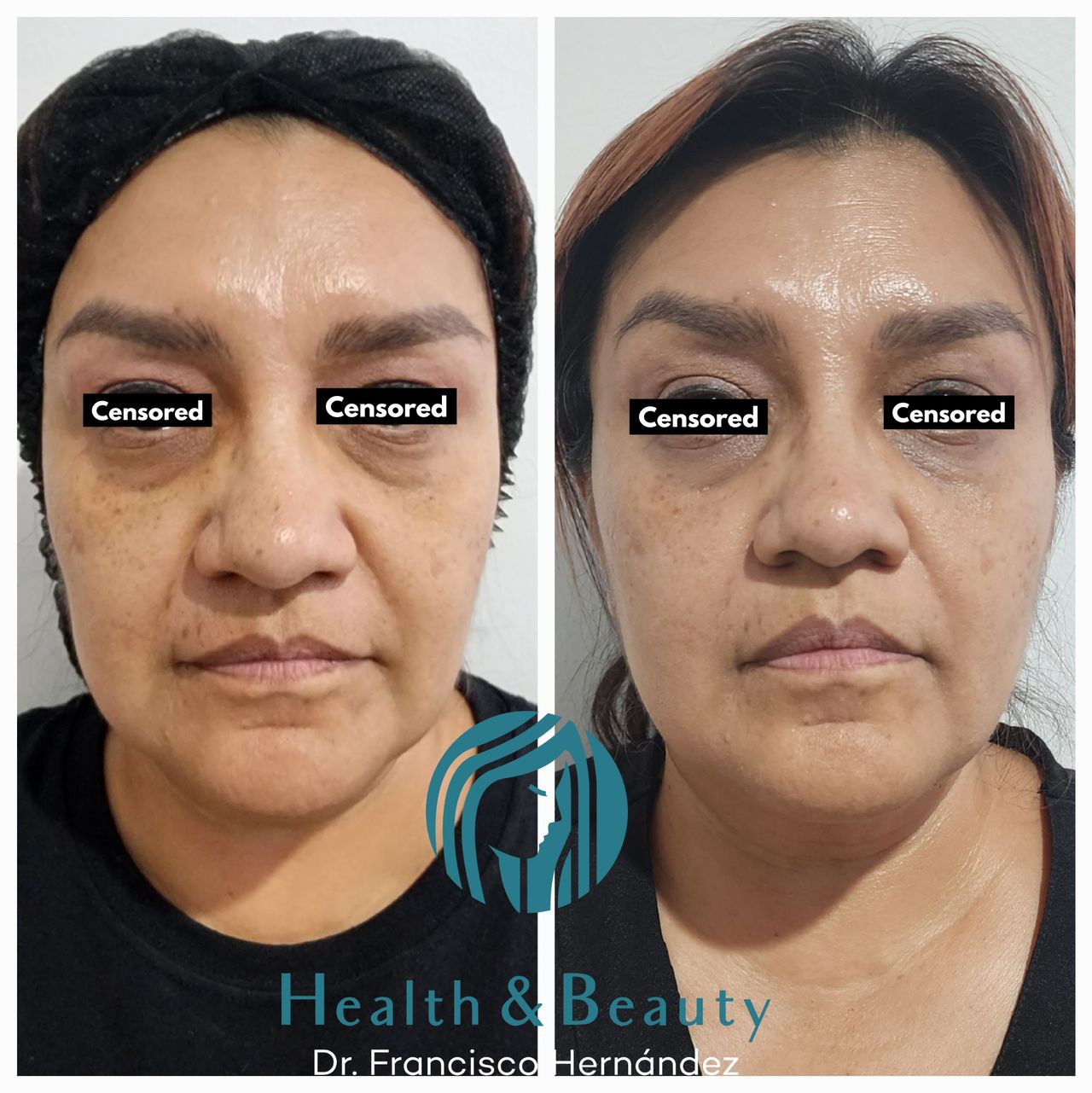 Francisco Hernández Gómez Crespo-72