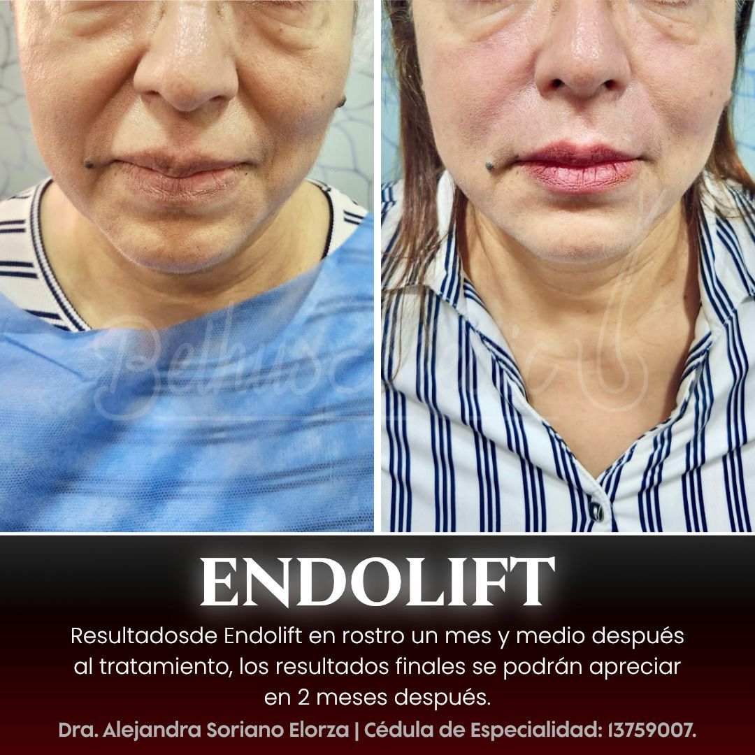 Alejandra Soriano Elorza-64