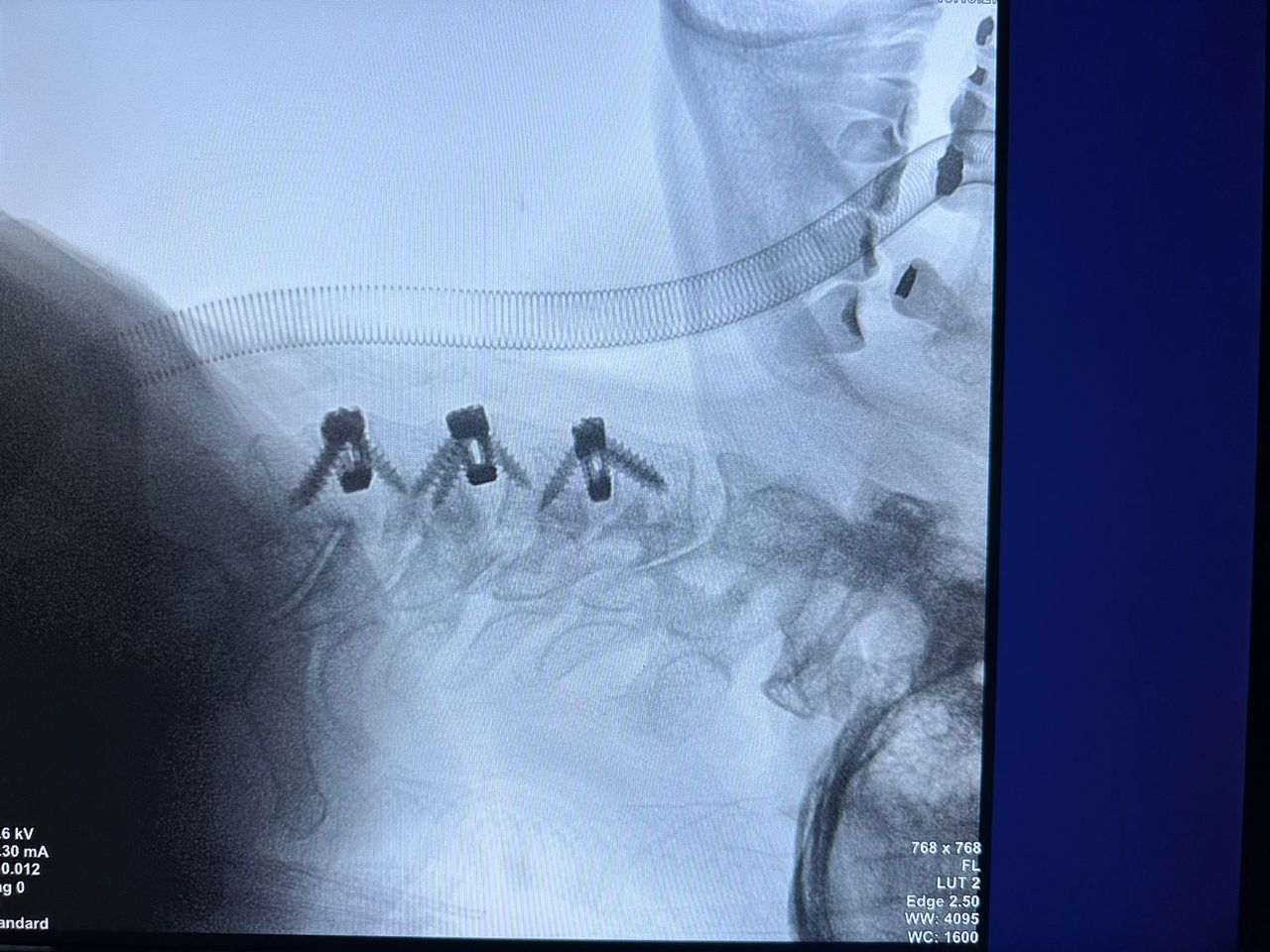 Gerson Reyes Rodríguez-30