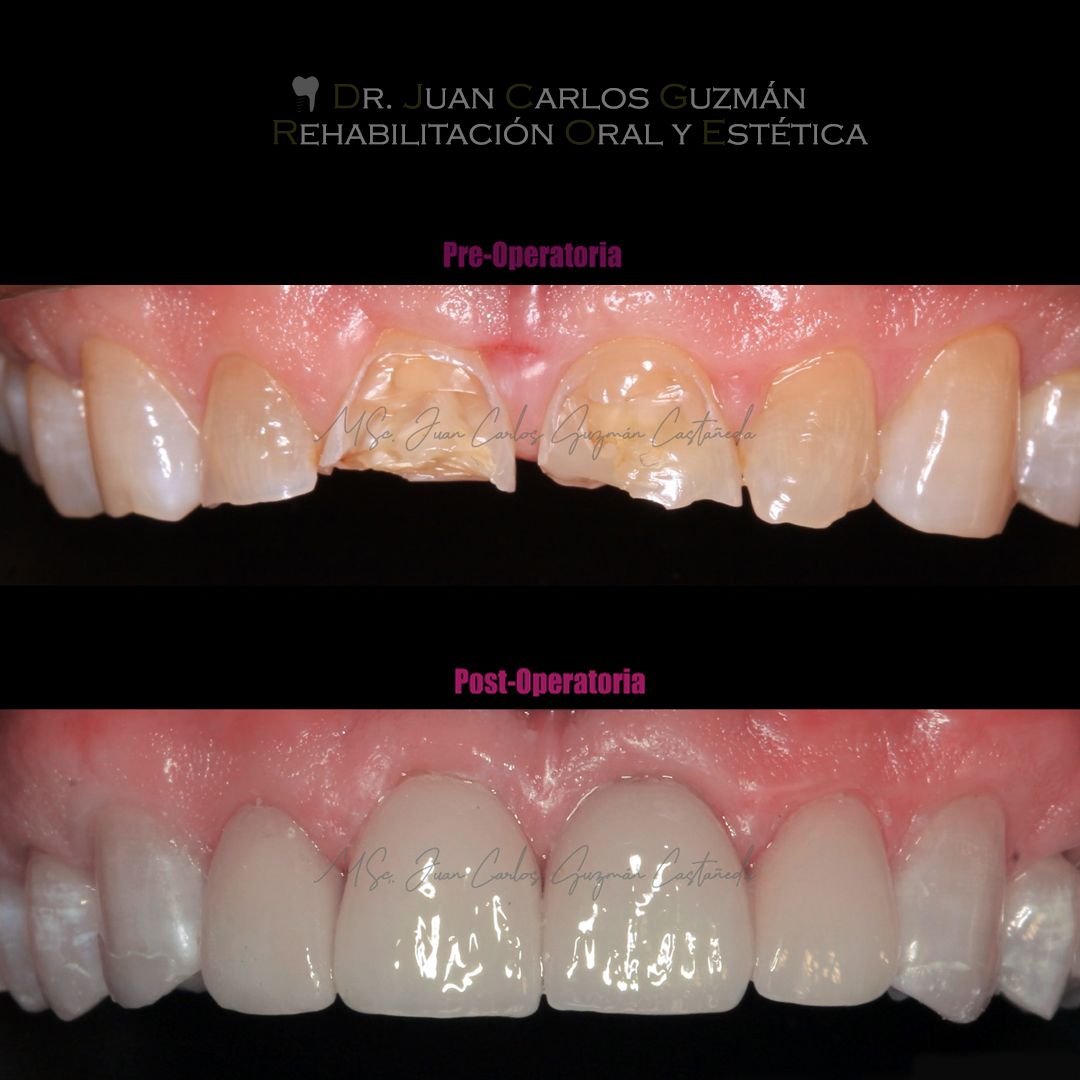 Juan Carlos Guzmán Castañeda-23