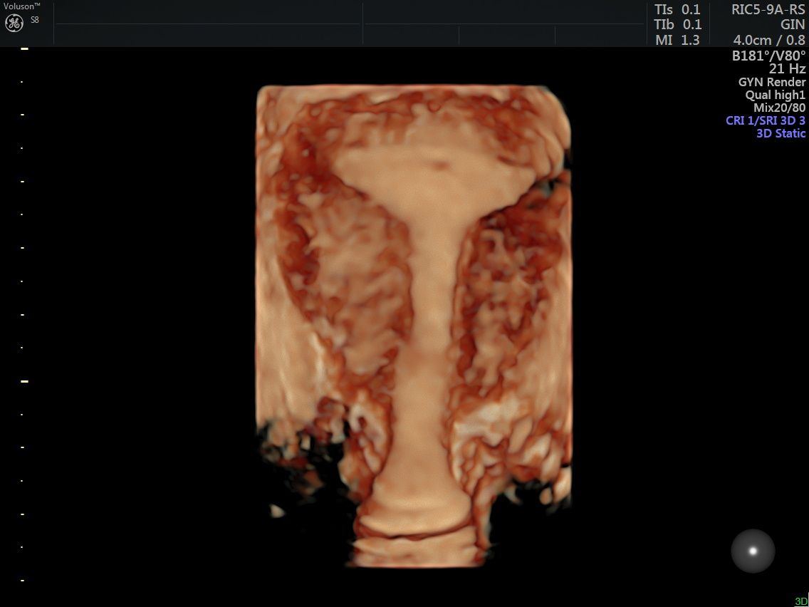 Griselda Reyes Torres-74