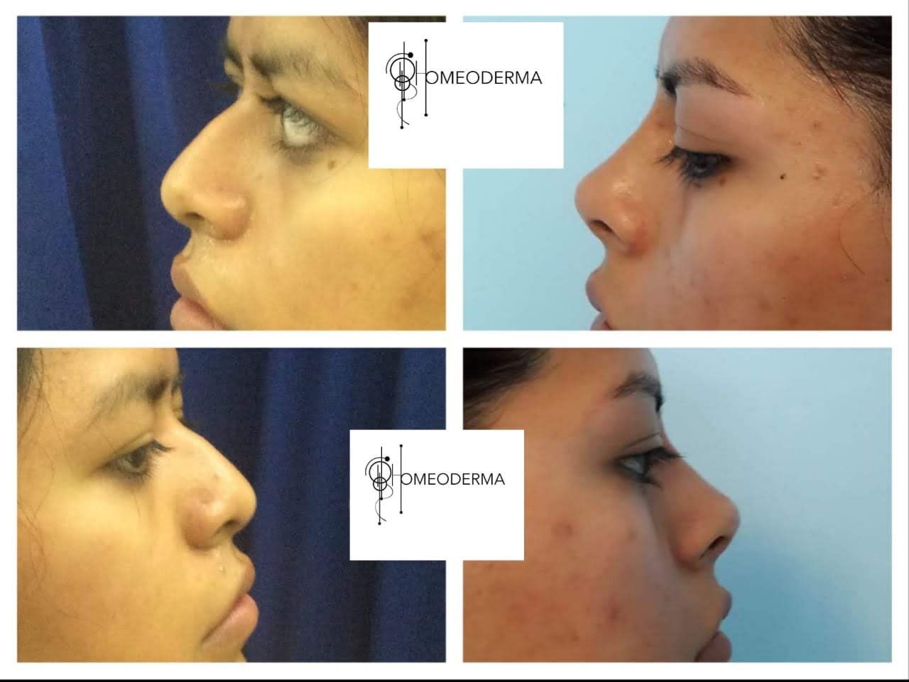 Gilliar Emmanuel Eudave De Lima-18