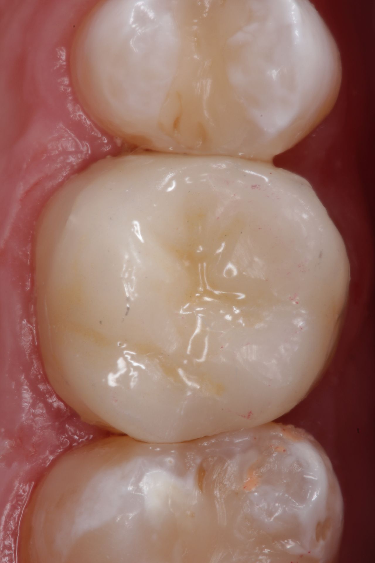 Sebastian Enrique Pérez Alvarez-2