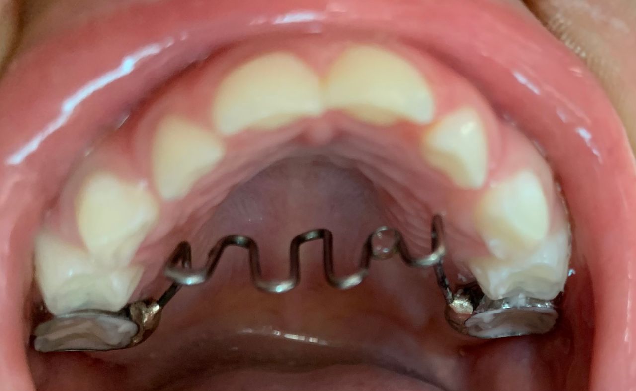 Mirely Peralta Rodríguez-3