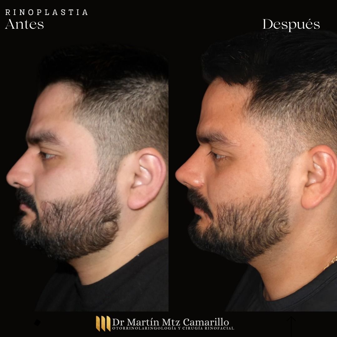 Martín Martínez Camarillo-24