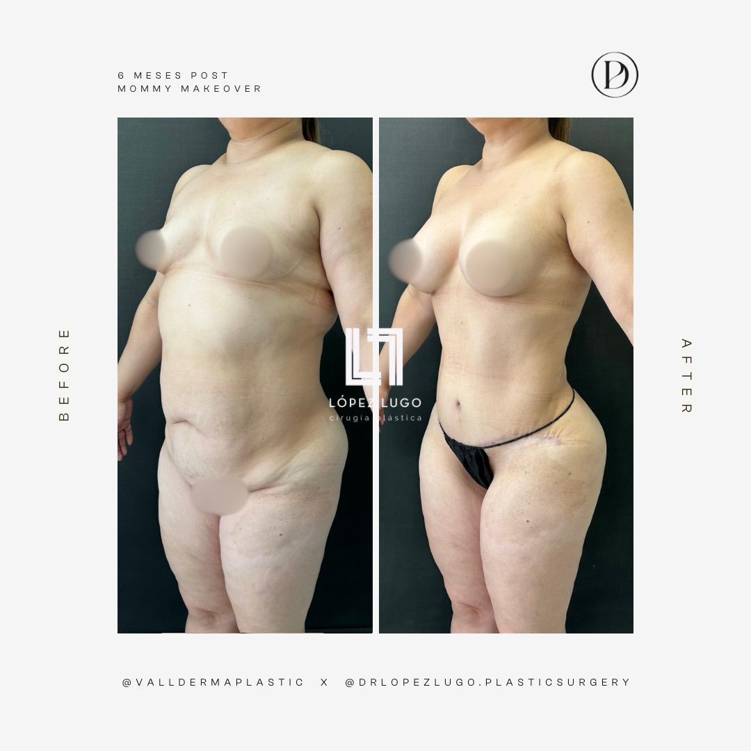 Omar Federico López Lugo-18