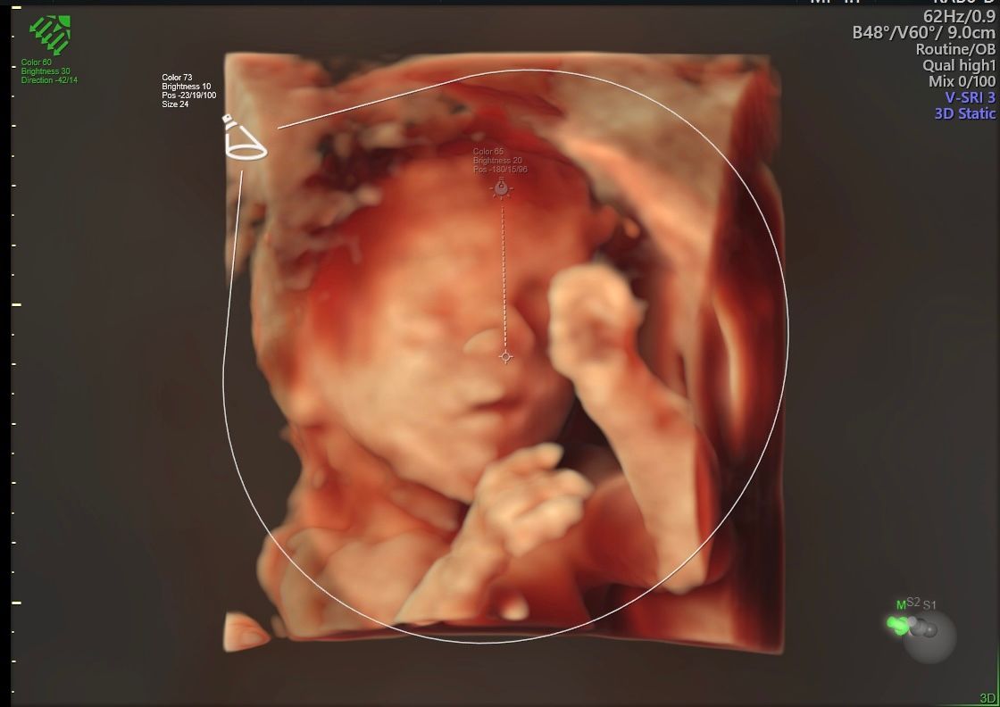 Erik Fernando González Martínez-6