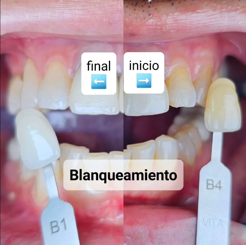 Alejandro Zamora Córdova-11