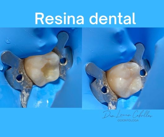 Laura Ceballos Brito-9