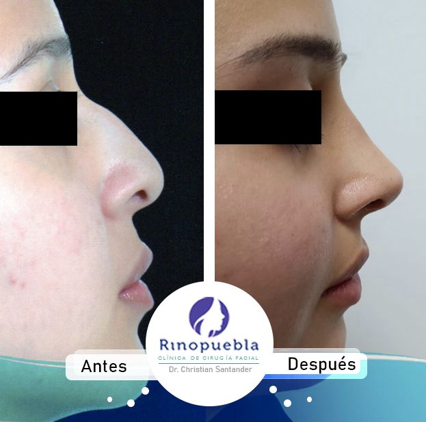 Christian Santander Becerra-25