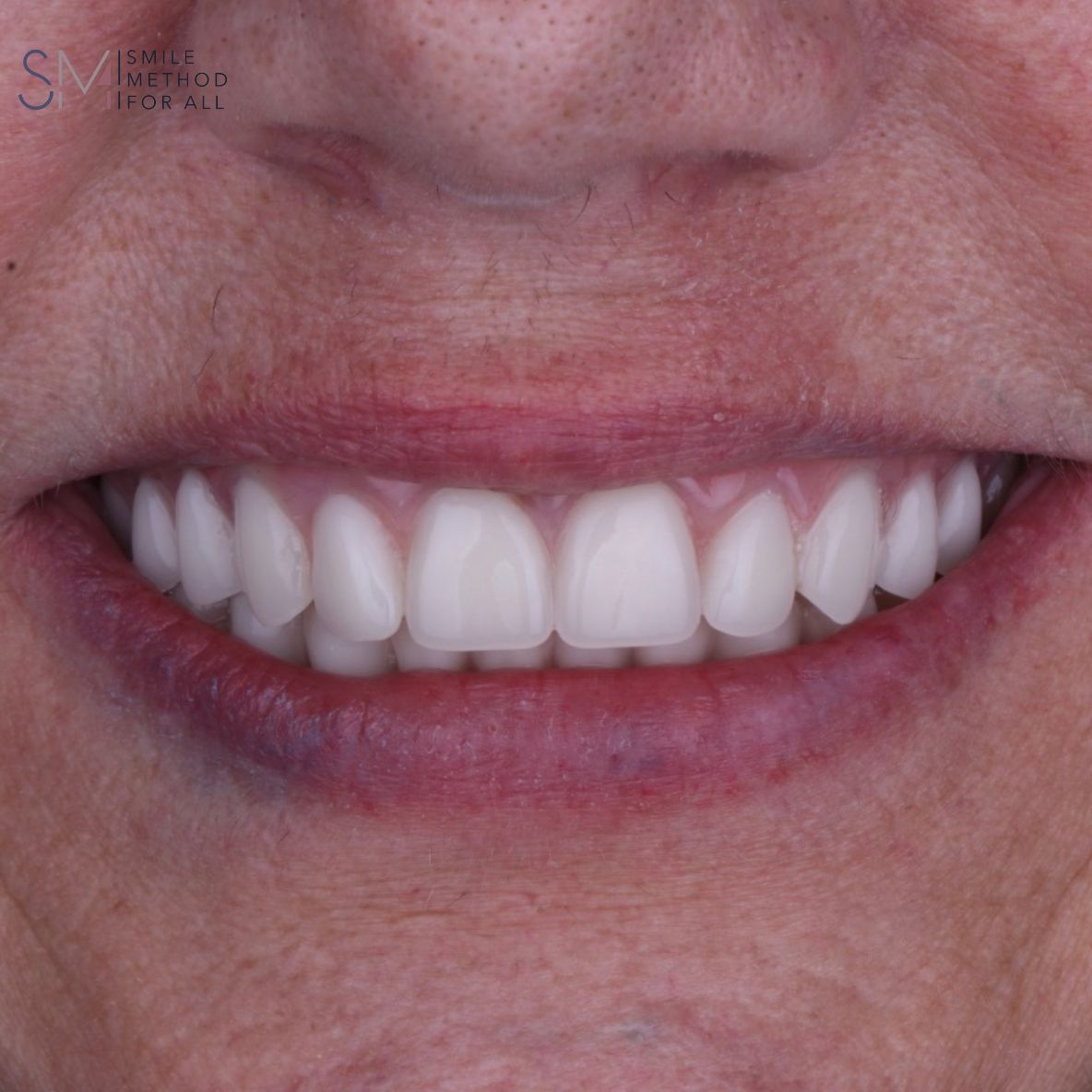 Arturo Mendez Valencia-40