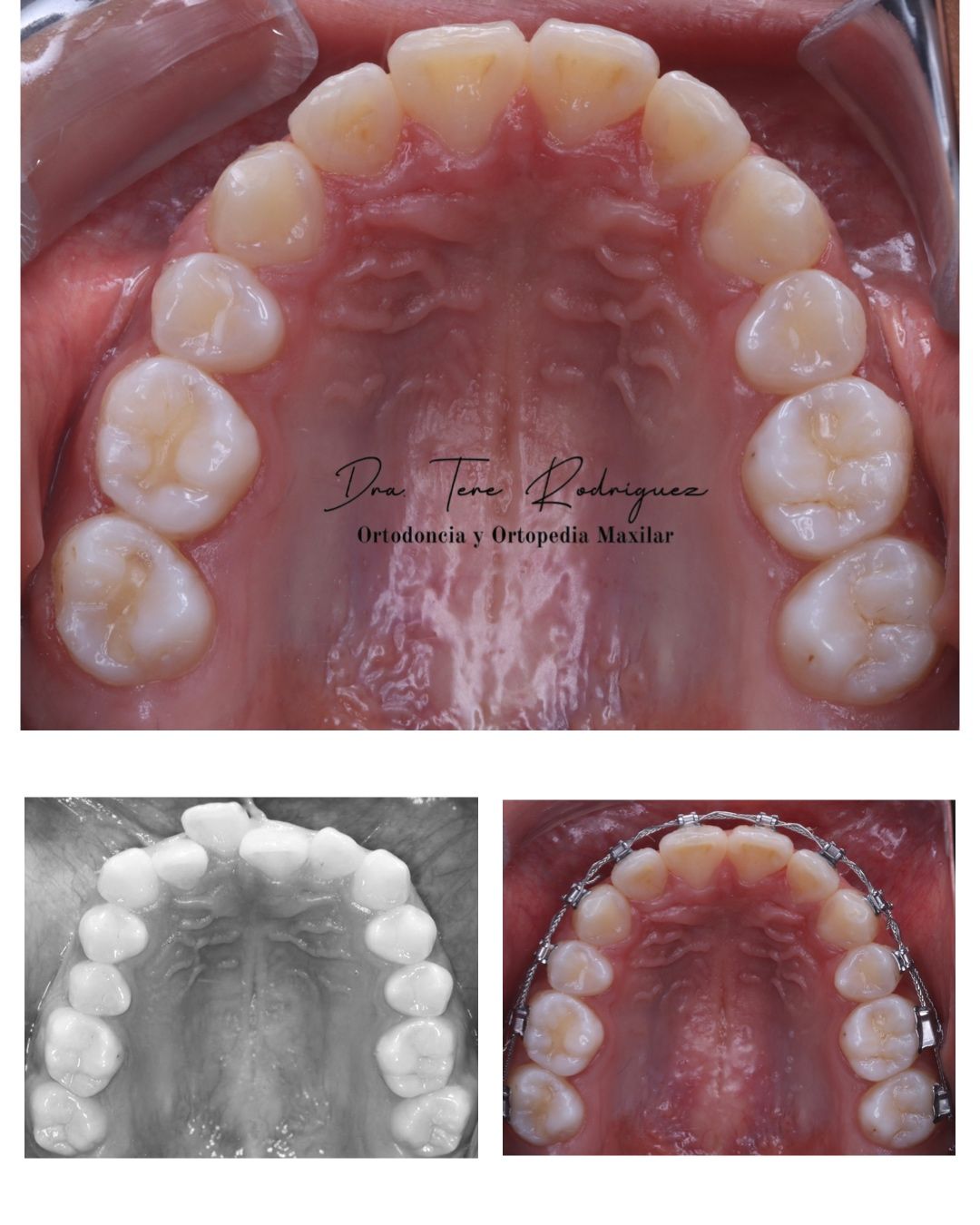 Teresa Rodriguez Candia-5