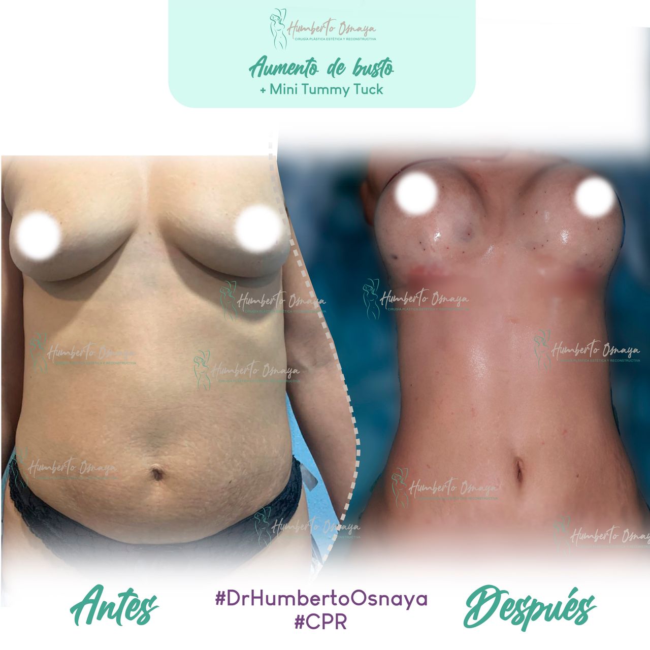 Humberto Osnaya Moreno-39