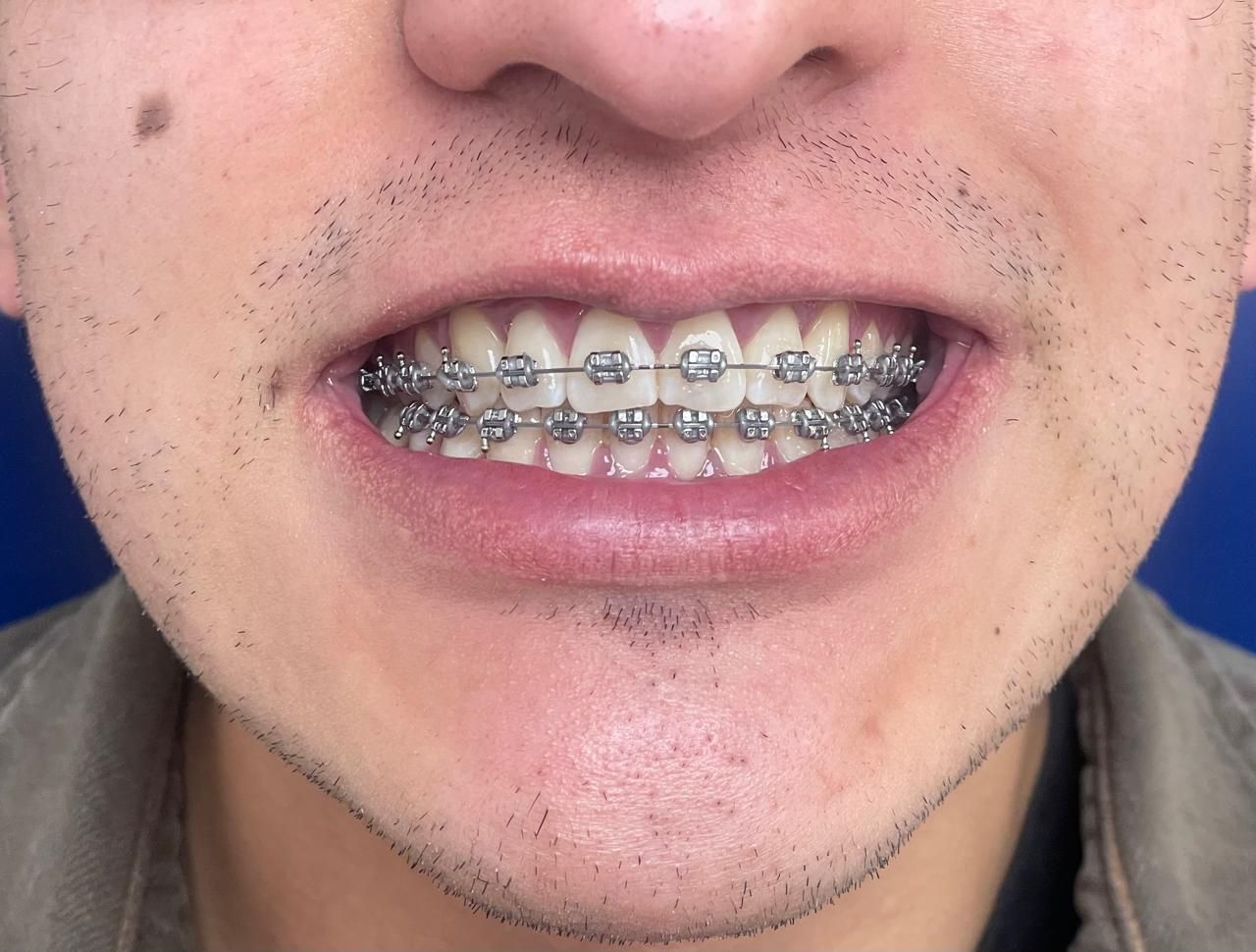 Anuar Becerril Castro-17