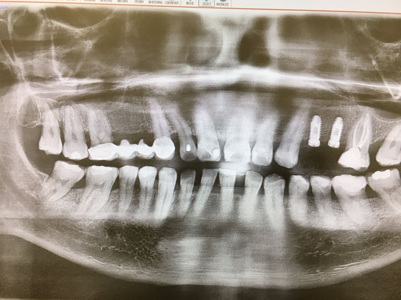 Luis Humberto Garcia Cabrera-3