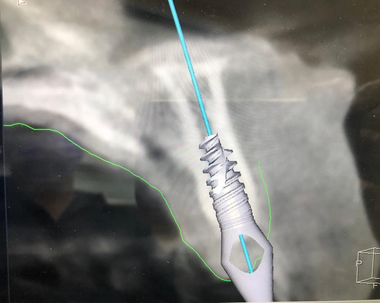 José Alberto Martínez Basulto-16