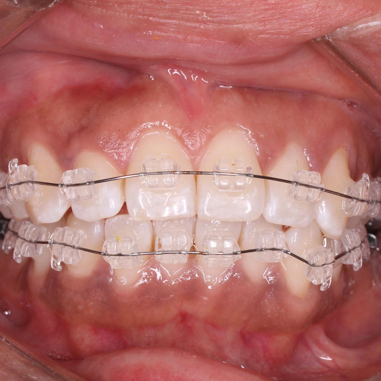 Citlalli Escamilla Martínez-4