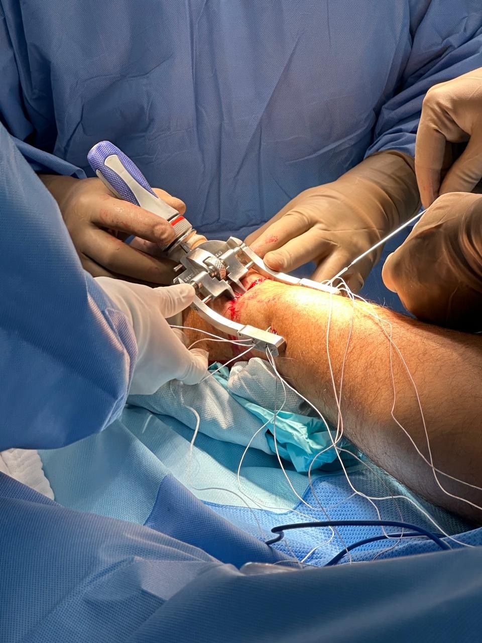 Jonatan Garcia  Garcia-3