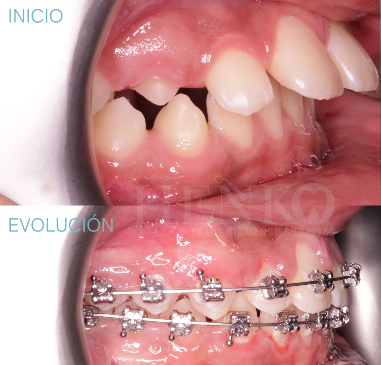Zurisadai Salinas Chávez-17