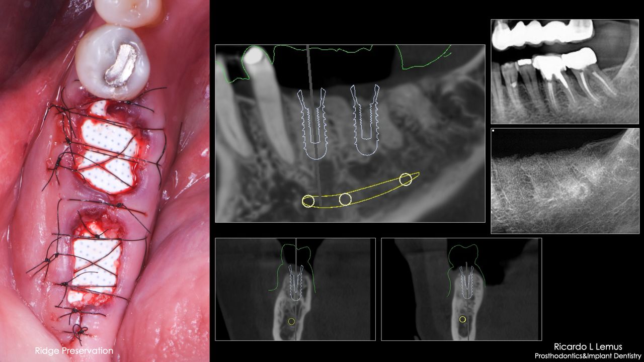 Ricardo López Lemus-112