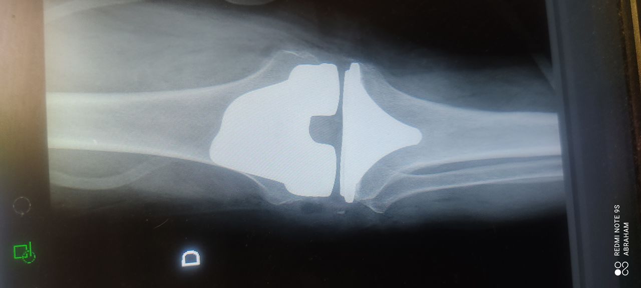 Abraham Israel Tachiquín Ruiz-4