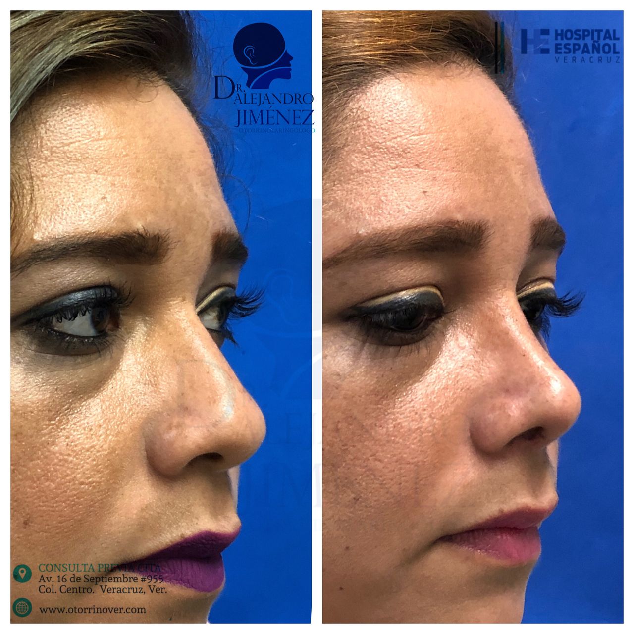 Alejandro Jimenez Garcia-17