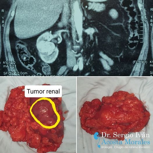 Sergio Iván Acosta Morales-27