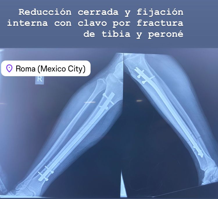 Jonatan Garcia  Garcia-1