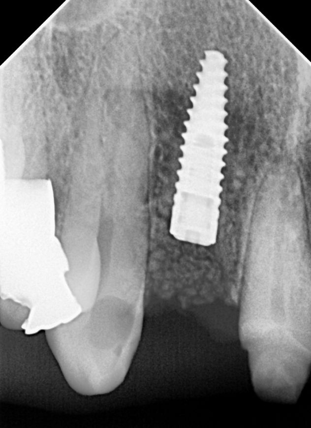 Berenice Ontiveros-8