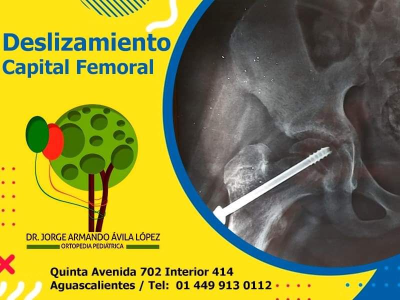 Jorge Armando Avila López-22