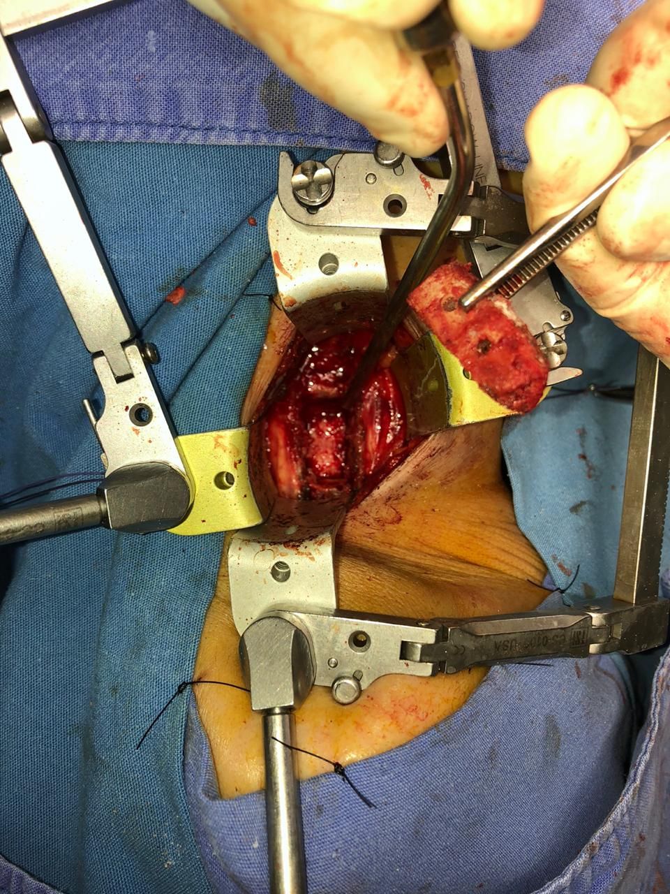 Juan José Luévano De La Cruz-11