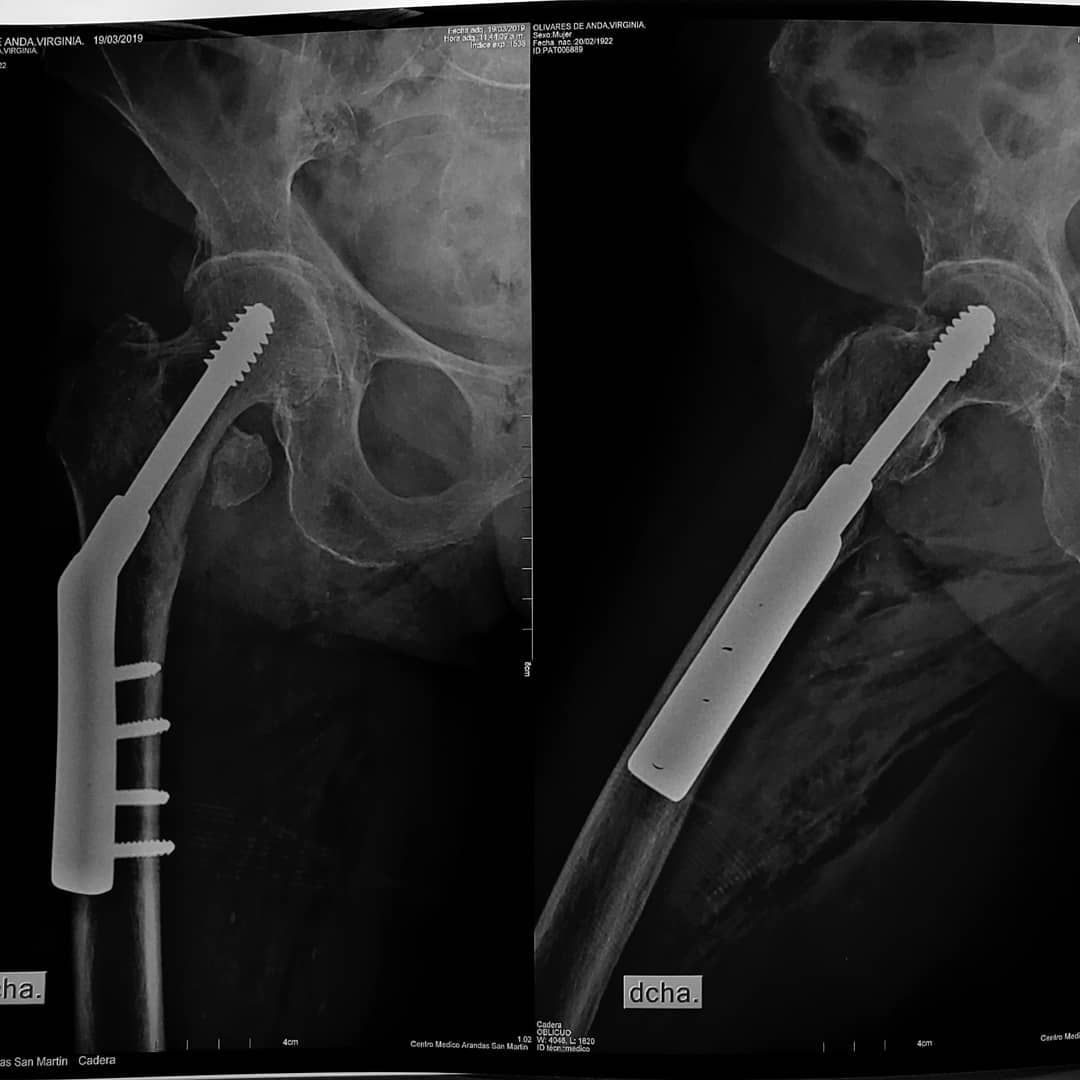 Víctor Hugo Campos Vivas-1