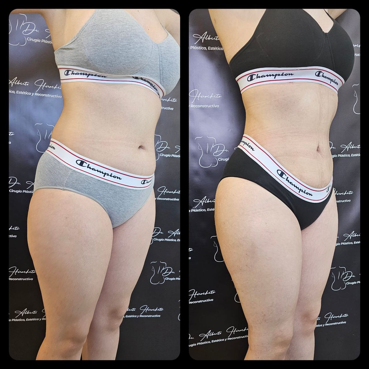 Alberto Hiracheta Torres-14