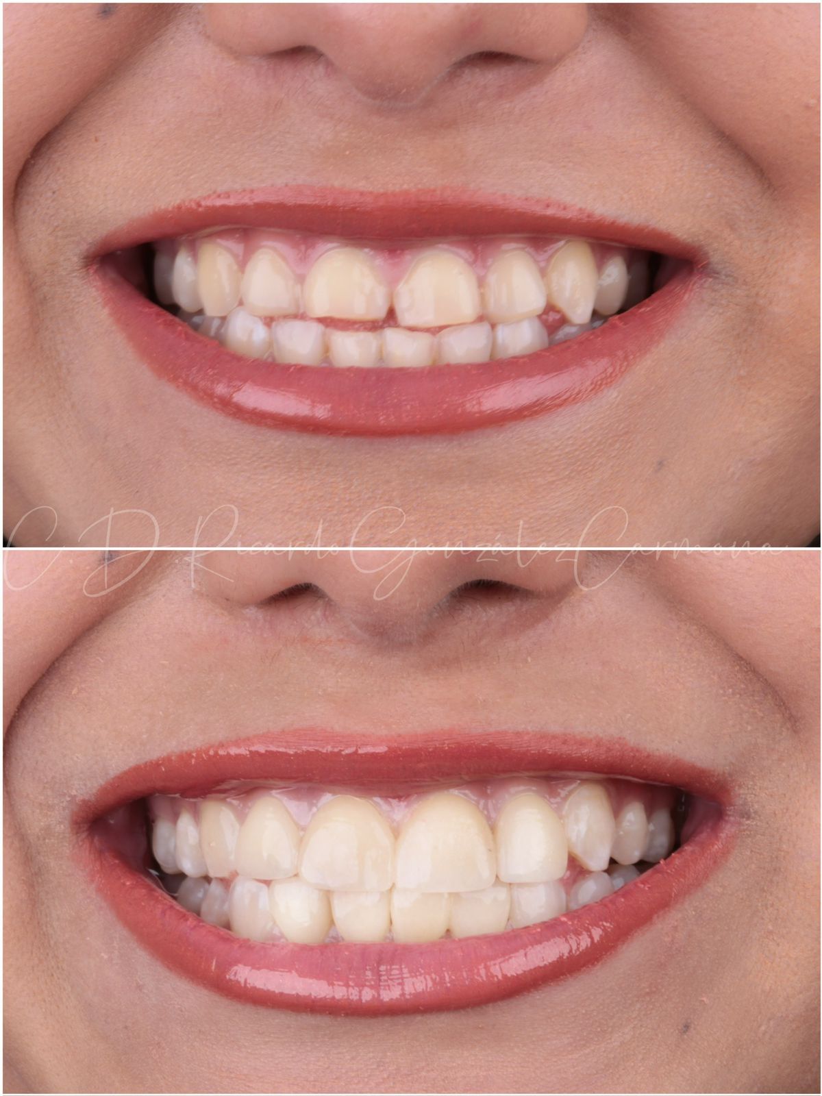 Ricardo González Carmona-17