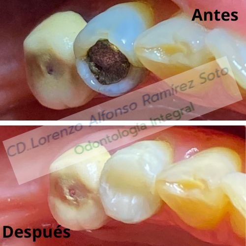 Lorenzo Alfonso Ramìrez Soto-1