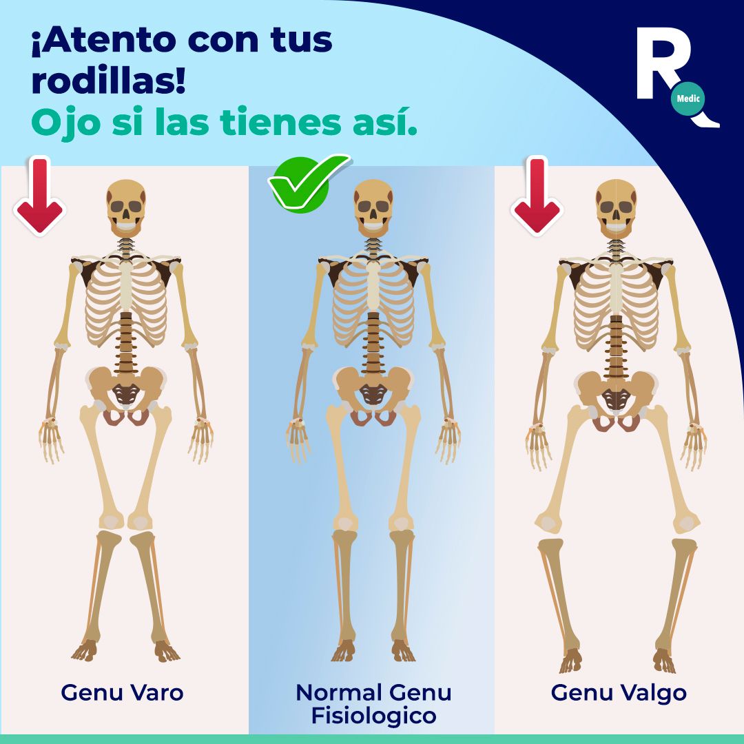 Lorena Rojas Alcántara-4